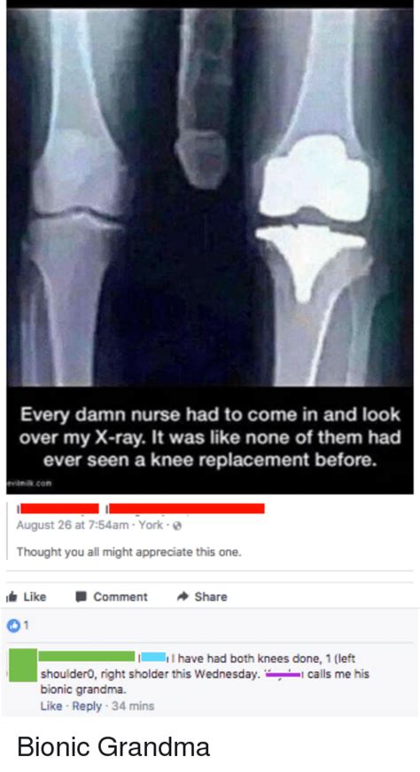 Knee surgery Memes