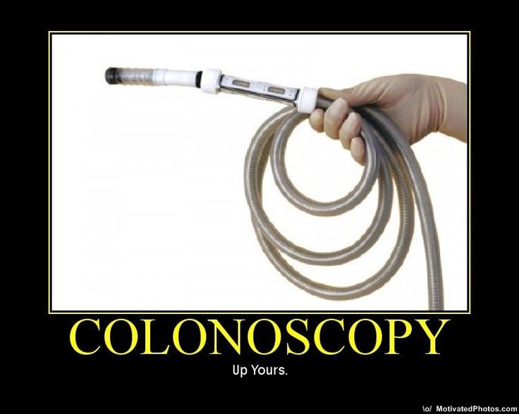 Funny colonoscopy. 